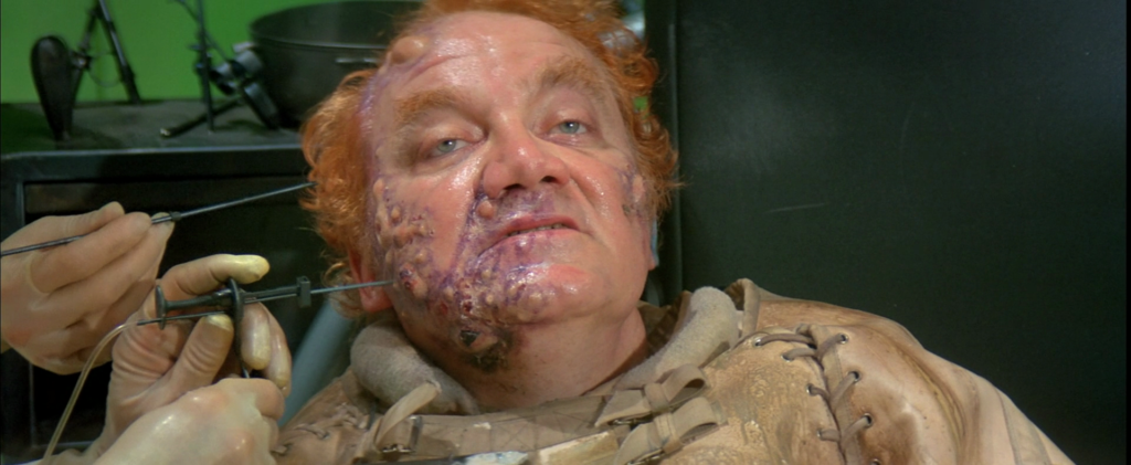 Baron Vladimir Harkonnen (Kenneth McMillan) reclines as unseen medics hold needles up to the pustules covering his face.