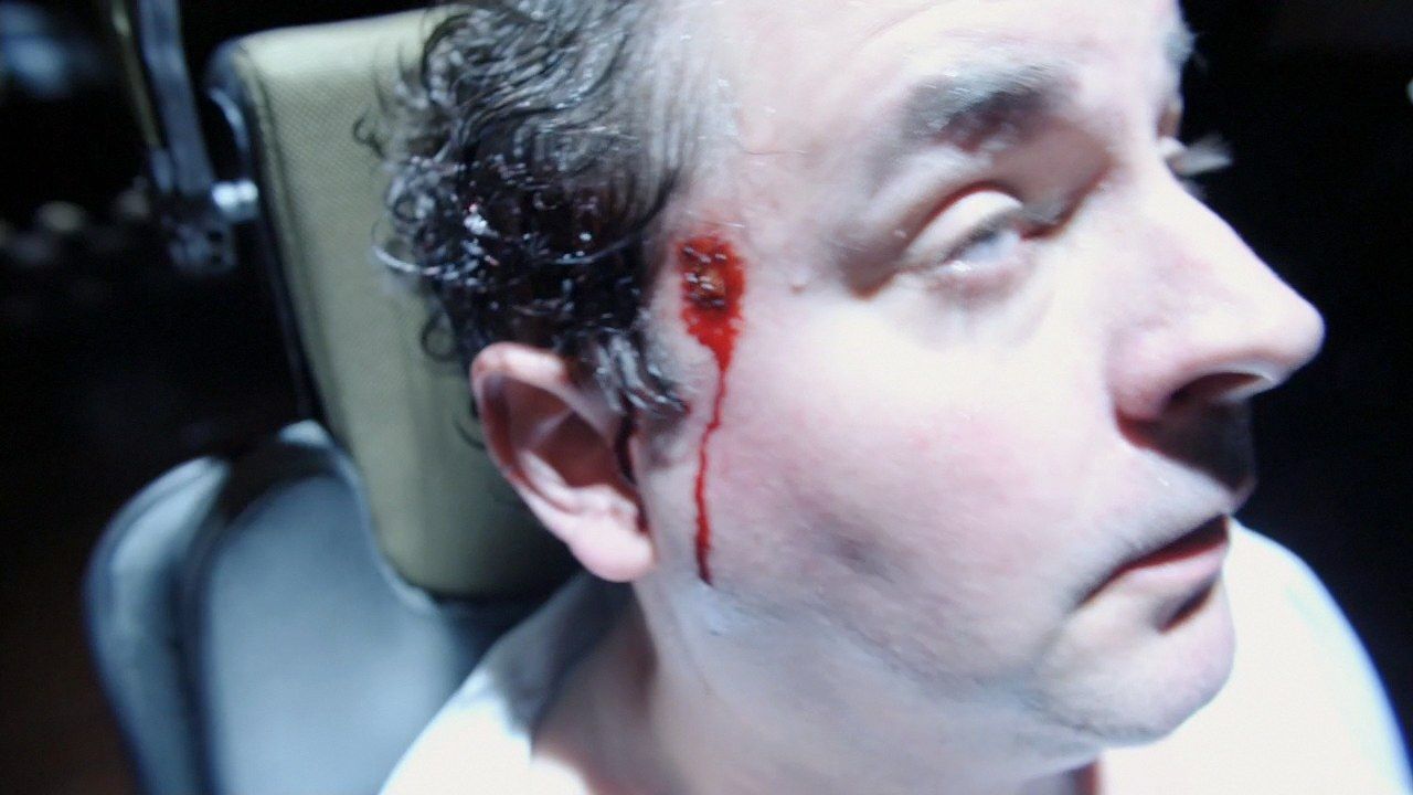 Jeremy Franklin (Mark Burgess) bleeds from his temples.